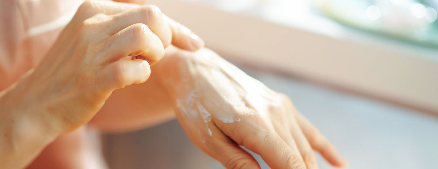 Neurodermatită: explicațiile unui dermatolog și opțiunile de tratament