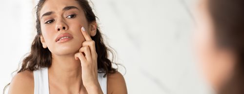 Acnee hormonală: Un dermatolog explică ce se poate face împotriva ei